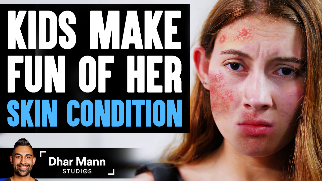 kids make fun or girls skin condition dhar mann video